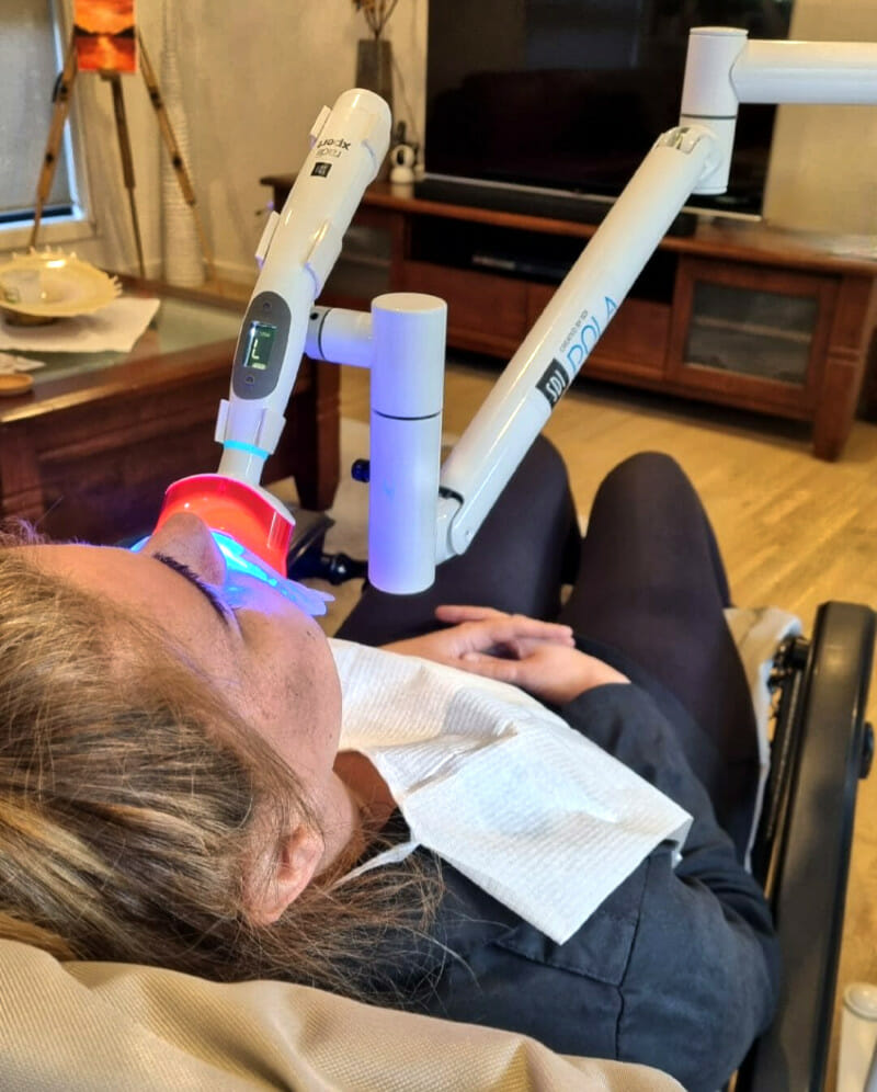 Teeth Whitening at home professionally